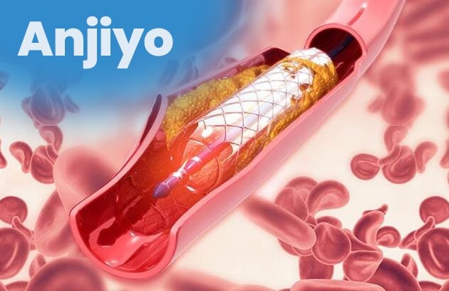 Homepage Anjiyo Homepage Anjiyo