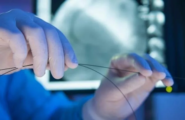 Biliary Stent Placement for Obstructive Jaundice: Procedure, Benefits and Risks Tikanma Sariliginda Safra Stenti Yerlestirilmesi