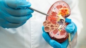 Tratament nechirurgical chist renal Ameliyatsiz Bobrek Kisti Tedavisi