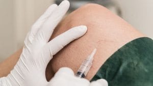 Tratament nechirurgical cu hidrocel: Scleroterapie Ameliyatsiz Hidrosel Tedavisi Skleroterapi