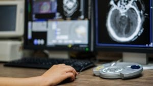 Embolizasyon Tedavisi Fiyatları Embolizasyon fiyatlari