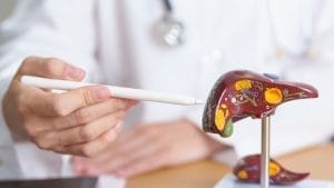 Tratament de ablație a tumorilor hepatice Karaciger Tumor Ablasyon Tedavisi