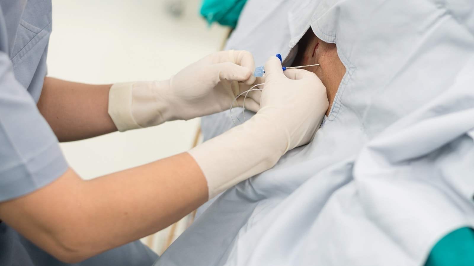 Targeted Therapy Prices Nokta Atisi Tedavisi Fiyatlari Targeted Therapy Prices Nokta Atisi Tedavisi Fiyatlari
