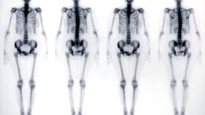 What Is Scintigraphy and How Is It Performed? Sintigrafi