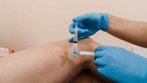 Scleroterapie (tratament cu spumă) Skleroterapi kopuk tedavisi