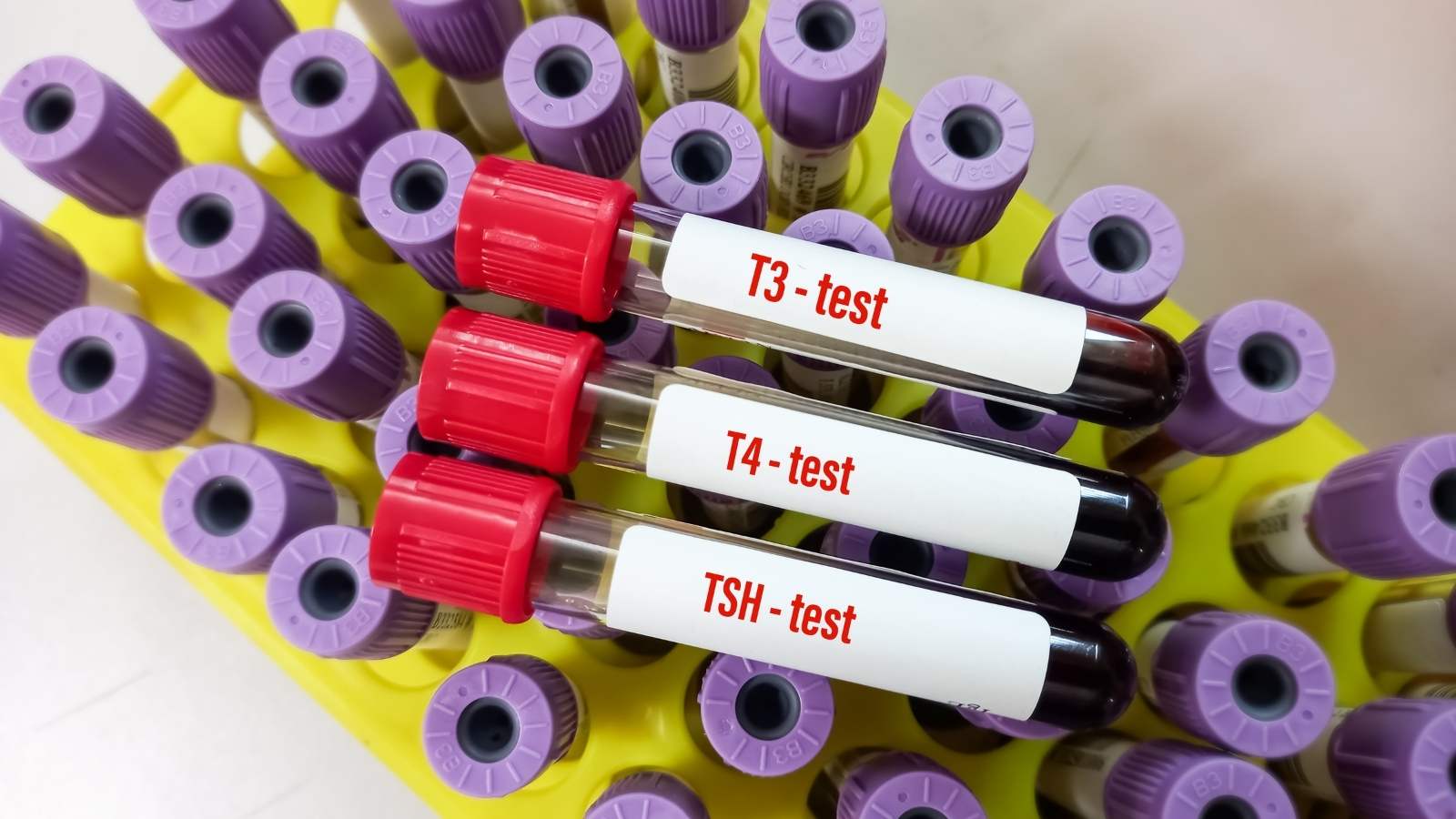 What Is TSH, What Does Low or High TSH Mean, and What Should the Ideal Level Be? TSH What Is TSH, What Does Low or High TSH Mean, and What Should the Ideal Level Be? TSH