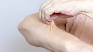 Sindromul Ehlers-Danlos Ehlers Danlos Sendromu