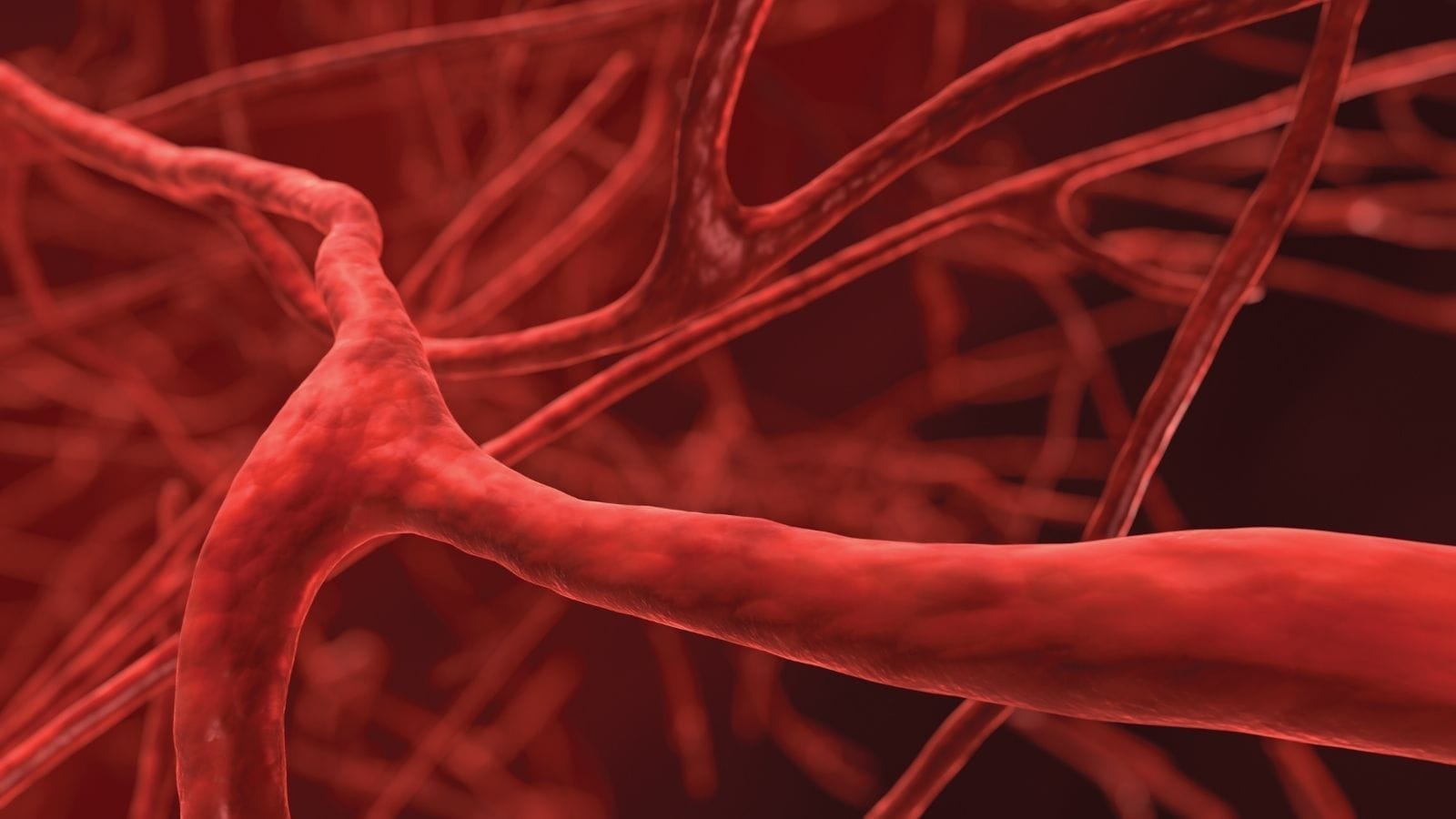 Thrombolyse Tromboliz Thrombolyse Tromboliz