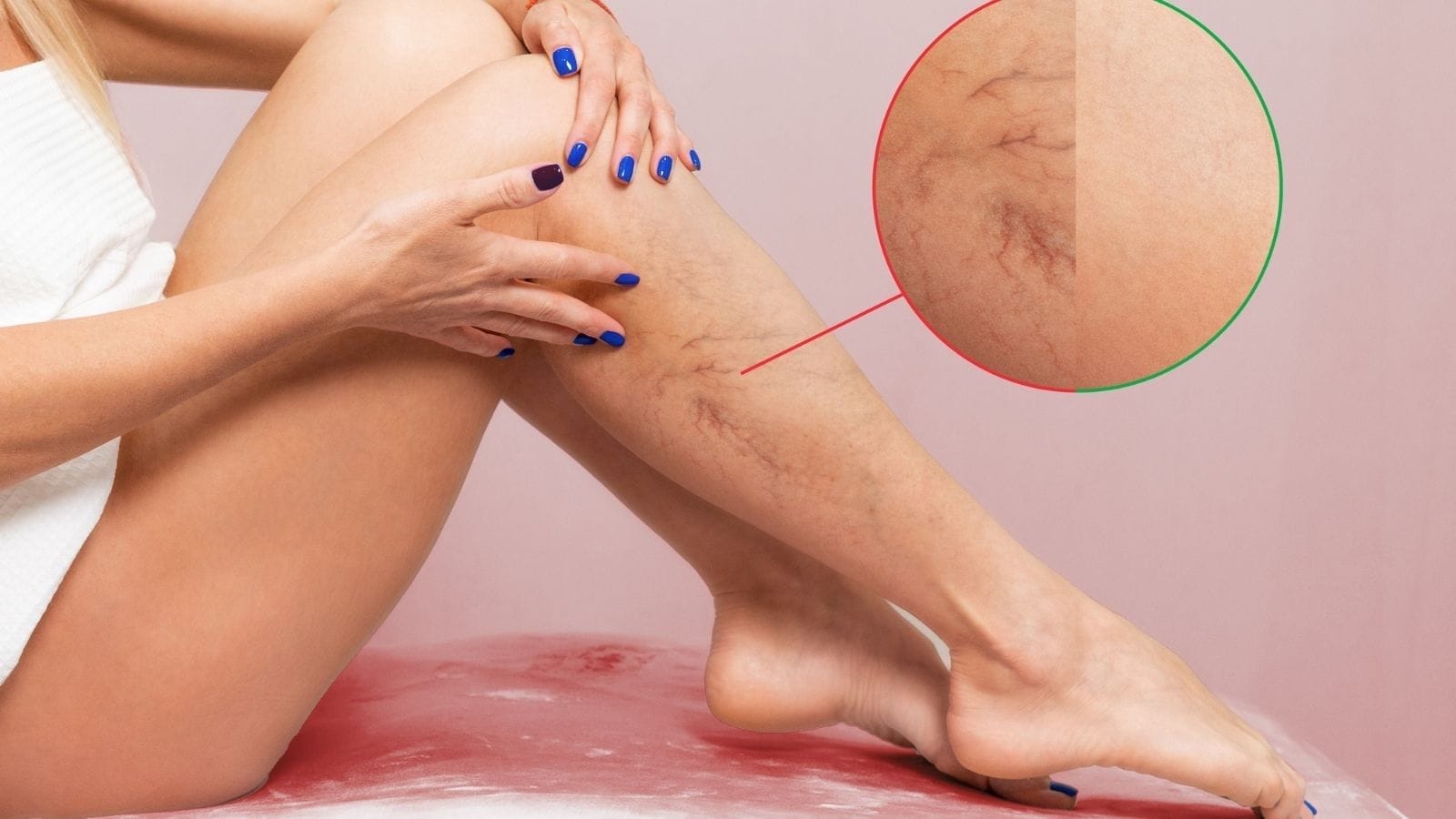 Leg Artery BlockageTreatment Bacak Damar Tikanikligi Nedir Belirtileri Tedavisi Leg Artery BlockageTreatment Bacak Damar Tikanikligi Nedir Belirtileri Tedavisi