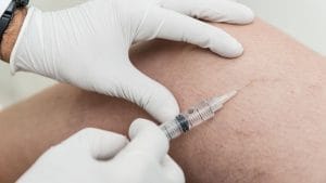 Sclerotherapy (Foam Treatment) Skleroterapi Kopuk Tedavisi Nedir Nasil Yapilir