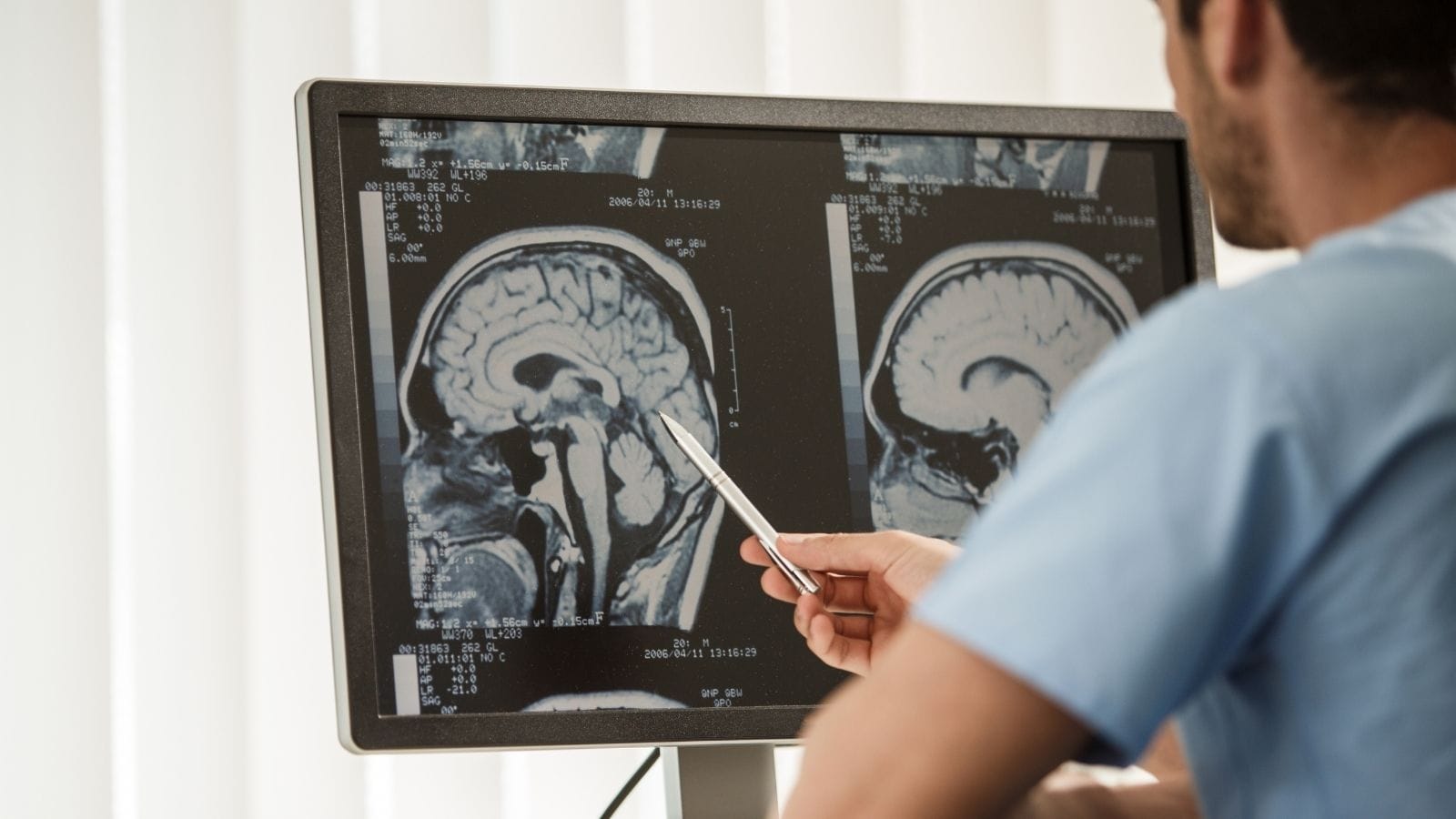 What Is Radiology? Which Diseases Does Radiology Cover? Radyoloji Nedir ve Neden Onemlidir What Is Radiology? Which Diseases Does Radiology Cover? Radyoloji Nedir ve Neden Onemlidir