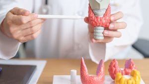 Tiroid Arter Embolizasyonu Tiroid Arter Embolizasyonu