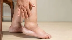Ce este Malformația? Care Sunt Cauzele Malformațiilor? Malformasyon Nedir Malformasyon Neden Olur