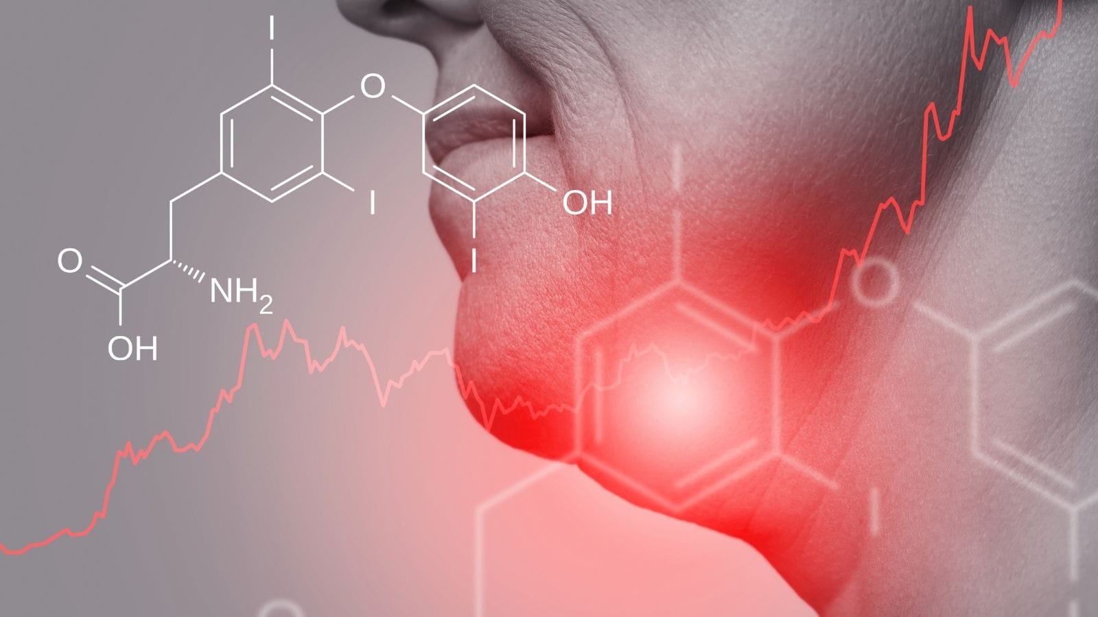 Serbest T3 (Triiyodotironin) Nedir? Yüksekliği ve Düşüklüğü Serbest T3 Triiyodotironin Nedir Yuksekligi ve Dusuklugu Serbest T3 (Triiyodotironin) Nedir? Yüksekliği ve Düşüklüğü Serbest T3 Triiyodotironin Nedir Yuksekligi ve Dusuklugu