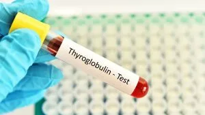 Ce este Tireoglobulina? Ce Înseamnă Anticorpii Anti-Tireoglobulină? Tiroglobulin Nedir Tiroglobulin Testi Neden Yapilir