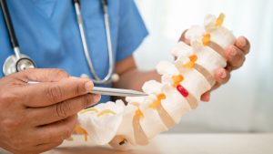 Bel Fıtığı Ne Zaman Ameliyat Gerektirir? Bel Fitigi Ne Zaman Ameliyat Gerektirir Bel Fıtığı Ne Zaman Ameliyat Gerektirir? Bel Fitigi Ne Zaman Ameliyat Gerektirir