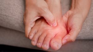 Ce este Hallux Valgus, care provoacă umflătură și durere la degetul mare al piciorului? Ayak Basparmaginda Sislik ve Agriya Neden Olan Halluks Valgus Nedir