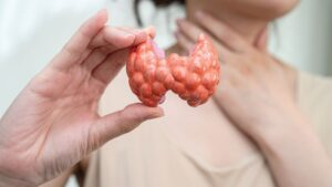 Comentarii de la persoane cu cancer tiroidian Tiroid Kanseri Olanlarin Yorumlari