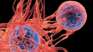 Cancer: Types, Early Symptoms, Causes and Treatment Options Kanser Nedir Kanser Belirtileri ve Nedenleri Nelerdir