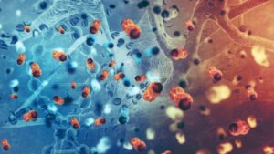 Bleomycin Electrosclerotherapy (BEST): Procedure and Applications Bleomycin electrosclerotherapy BEST